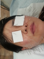 동안침 맑아지…